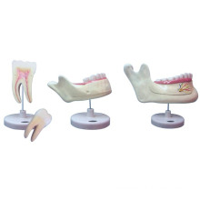 Dentes Molares Model/Dentes Decidui Model/Dentes Permanentes Model